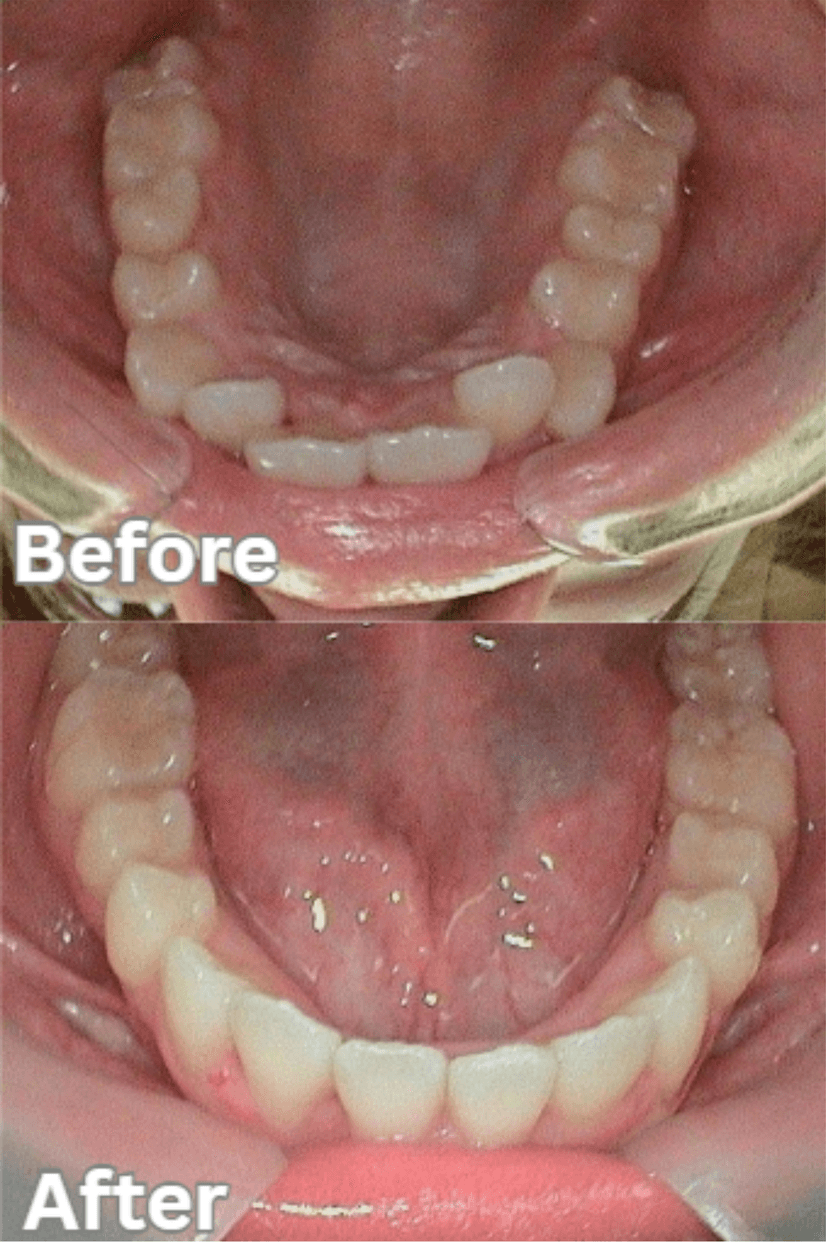 Before and After 4