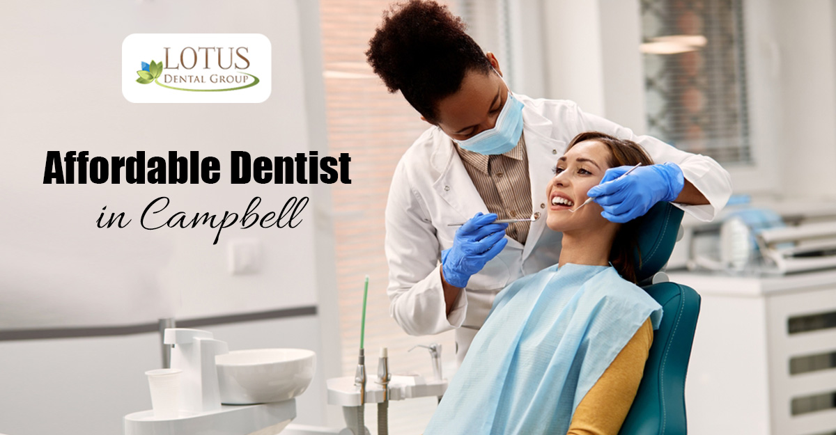 affordable-dentist-campbel